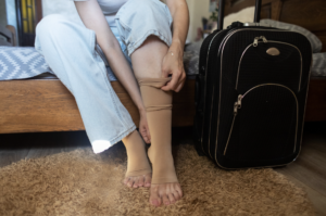 7 common myths about varicose veins
