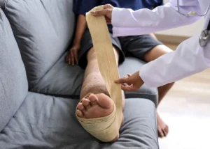 Chronic Venous Insufficiency: A Singapore Patient’s Guide