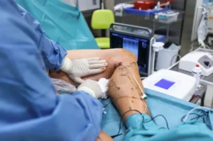 Surgeon performing radiofrequency ablation on marked leg veins in an operating room.